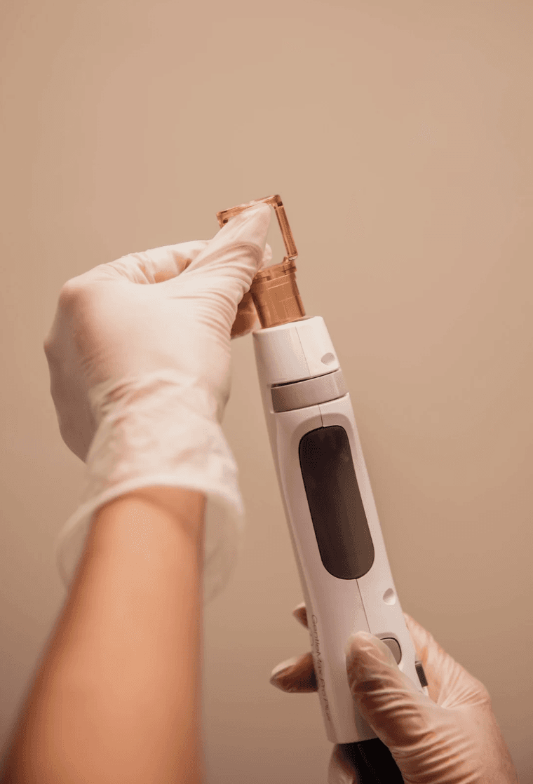 Laserontharing met de GentleMax Pro Plus: hoe werkt het en wat mag je verwachten? - 2